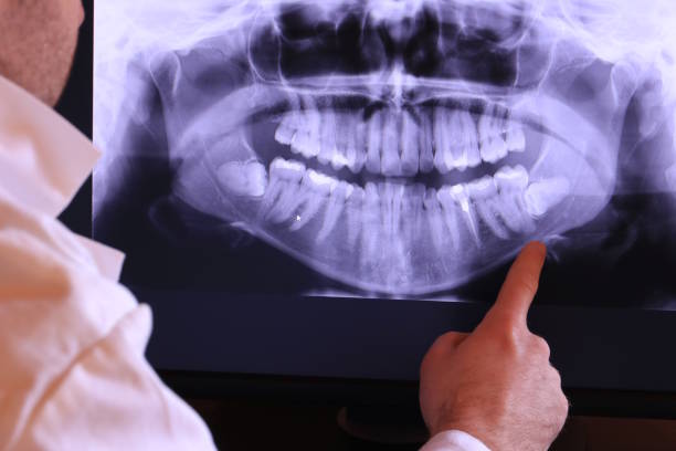 Best Emergency Dental Care for Abscessed Tooth in Church Hill, TN