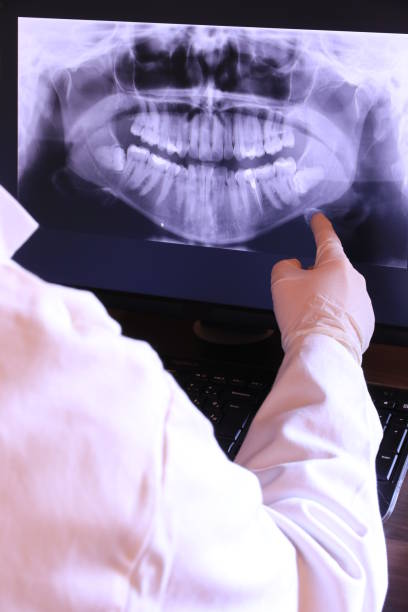 Best Emergency Dental Care for Abscessed Tooth in Church Hill, TN