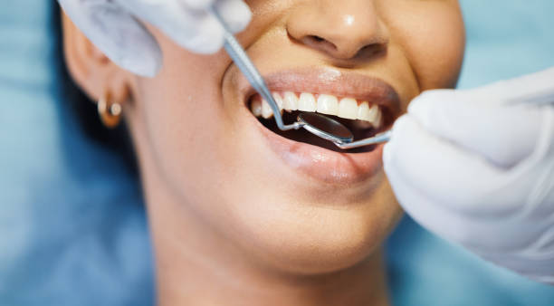 Best Emergency Dentist for Lost Fillings or Crowns in Church Hill, TN